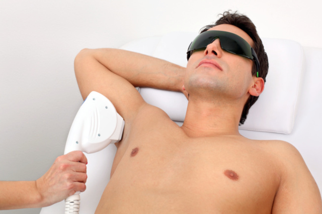 photo laser hair removal for men