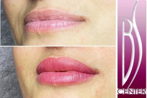 Permanentní make up rty Permanentní make up rty
