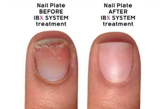 Ibx syst&eacute;m