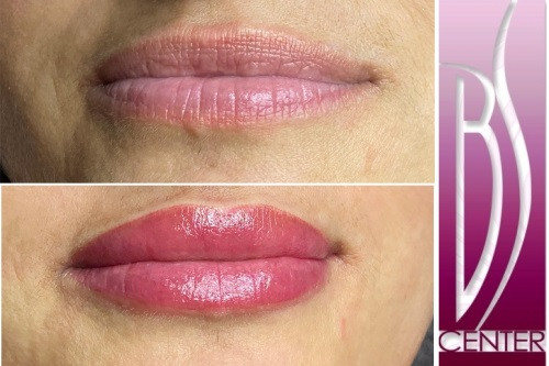 Permanentní 3D make-up rtů Permanentní 3D make-up rtů