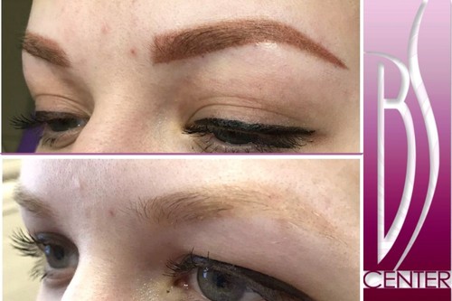 Permanent makeup removal eyebrow praha