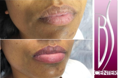 Permanent lips & lip liner. Aquarelle lips tattoo makeup | BEAUTYSHAPE  Prague