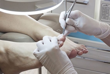 Вросший ноготь на пальце ноги: Избегайте хирурга