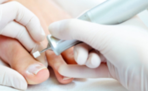 Лечение вросших ногтей - Удаление мозолей - Подология | BEAUTYSHAPE